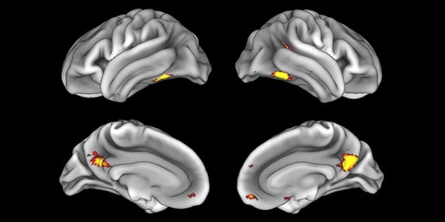 MultiBand SENSE fMRI faces vs places cortex