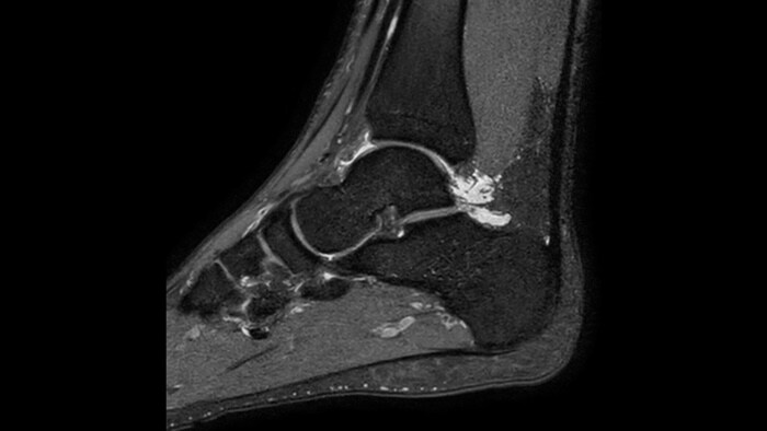 Ankle clinical image