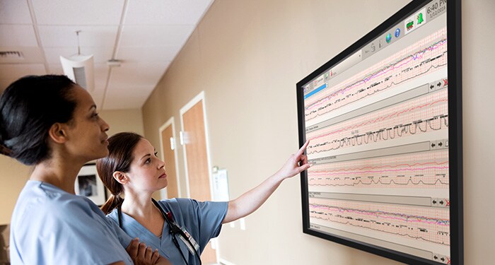 Central patient monitoring systems