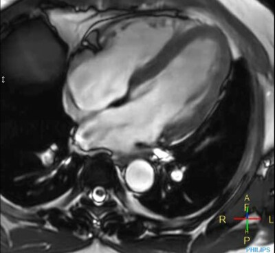 PHH philips smartspeed cardiac imaging