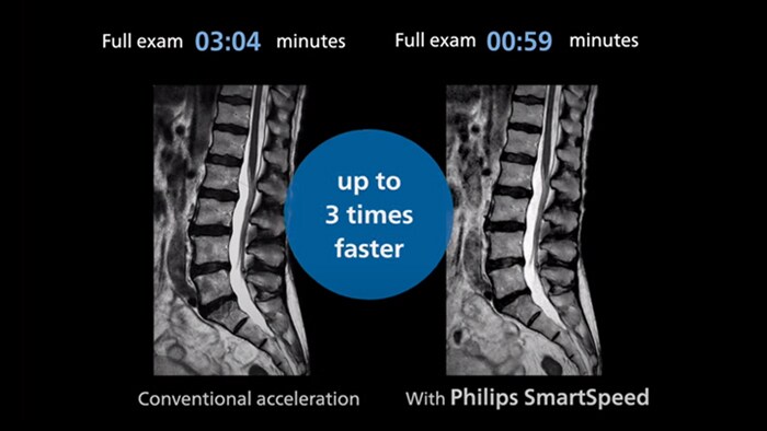 SmartSpeed Animation video thumb