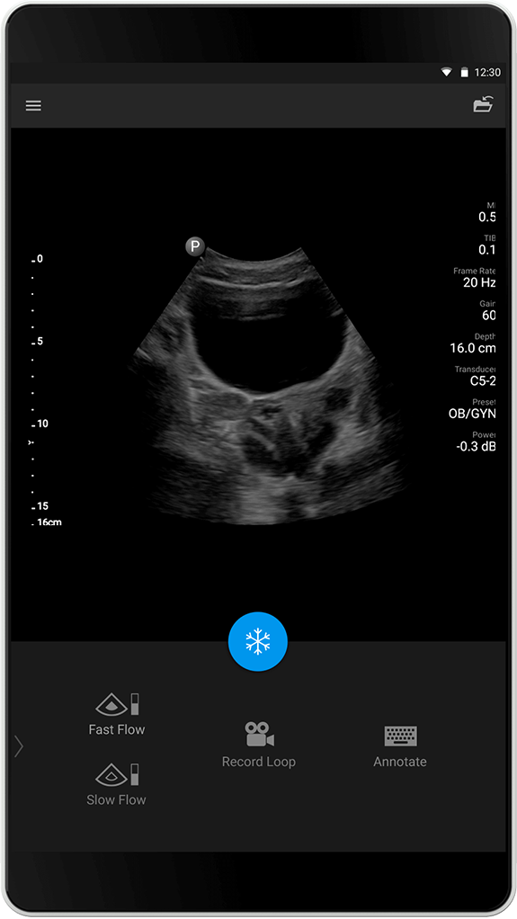 OB/GYN exam C5-2