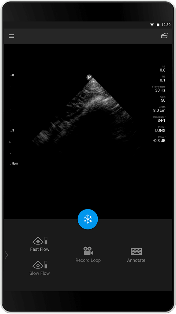 Lung exam S4-1